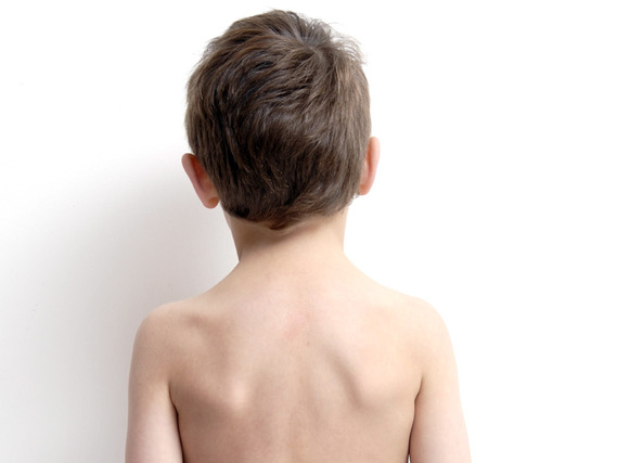 Qu&eacute; hacer si a mi hijo le duele la espalda